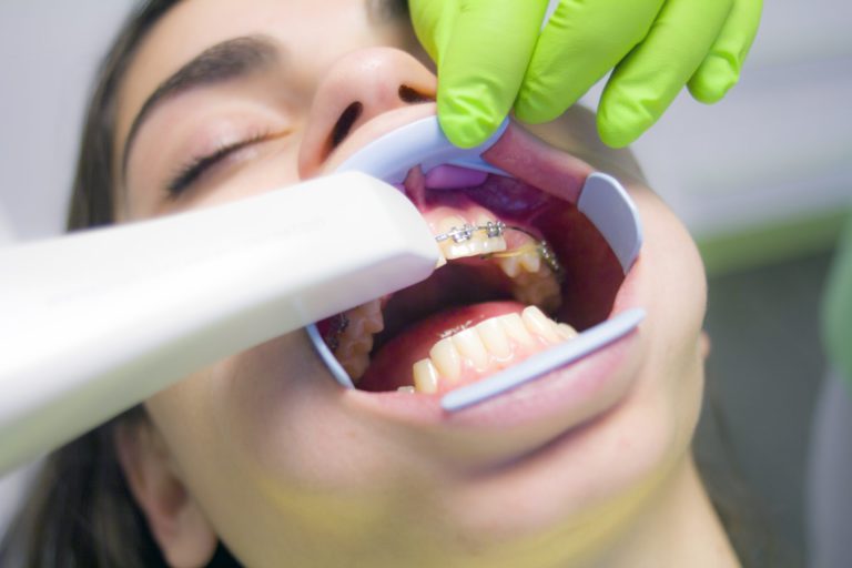 B.C. dentists urge province to move them to Phase 2 of vaccine rollout